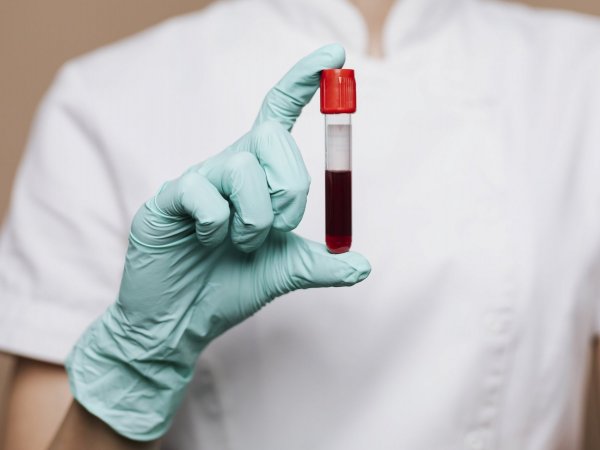 Mano de una enfermera sosteniendo un tubo con sangre.