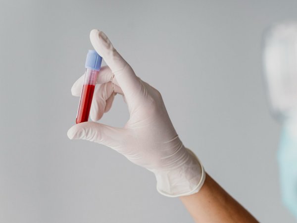 Examen de sangre para ver la creatinina