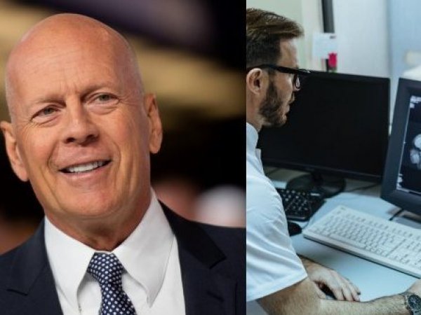 Bruce Willis y resonáncia magnética de cerebro