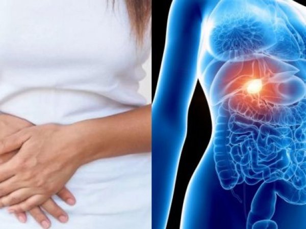 Mujer tomándose el costado del cuerpo y representación gráfica de la vesícula.