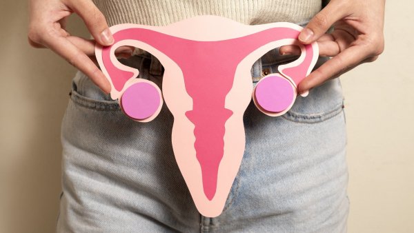 Cáncer cervico uterino