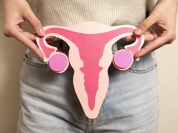 Cáncer cervico uterino