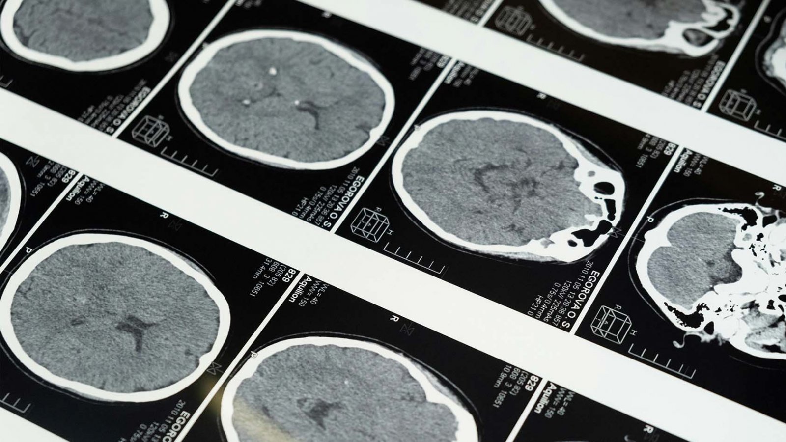 Investigadores trabajando en el estudio del envejecimiento cerebral en el laboratorio.