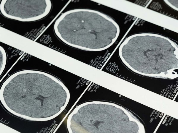 Investigadores trabajando en el estudio del envejecimiento cerebral en el laboratorio.