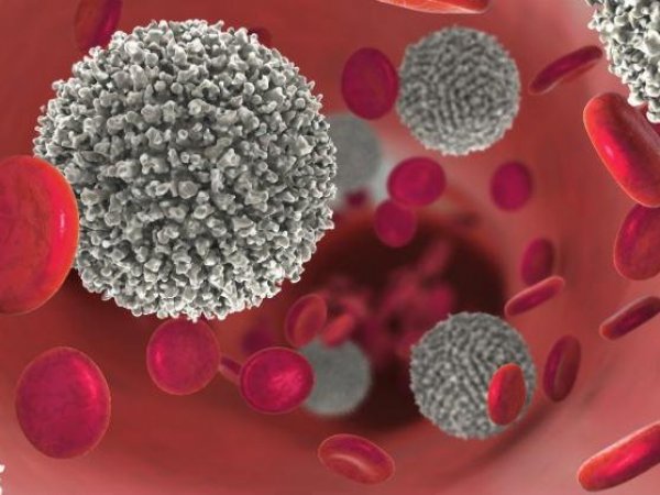 Leucemia mieloide crónica