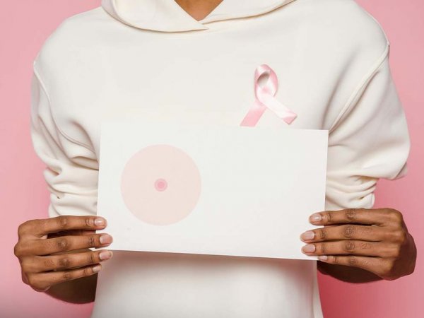 Imagen referencial del cáncer de mamas.