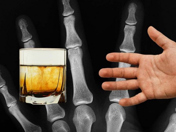 Comparación entre un dedo índice y un dedo anular para ilustrar la proporción 2D:4D.