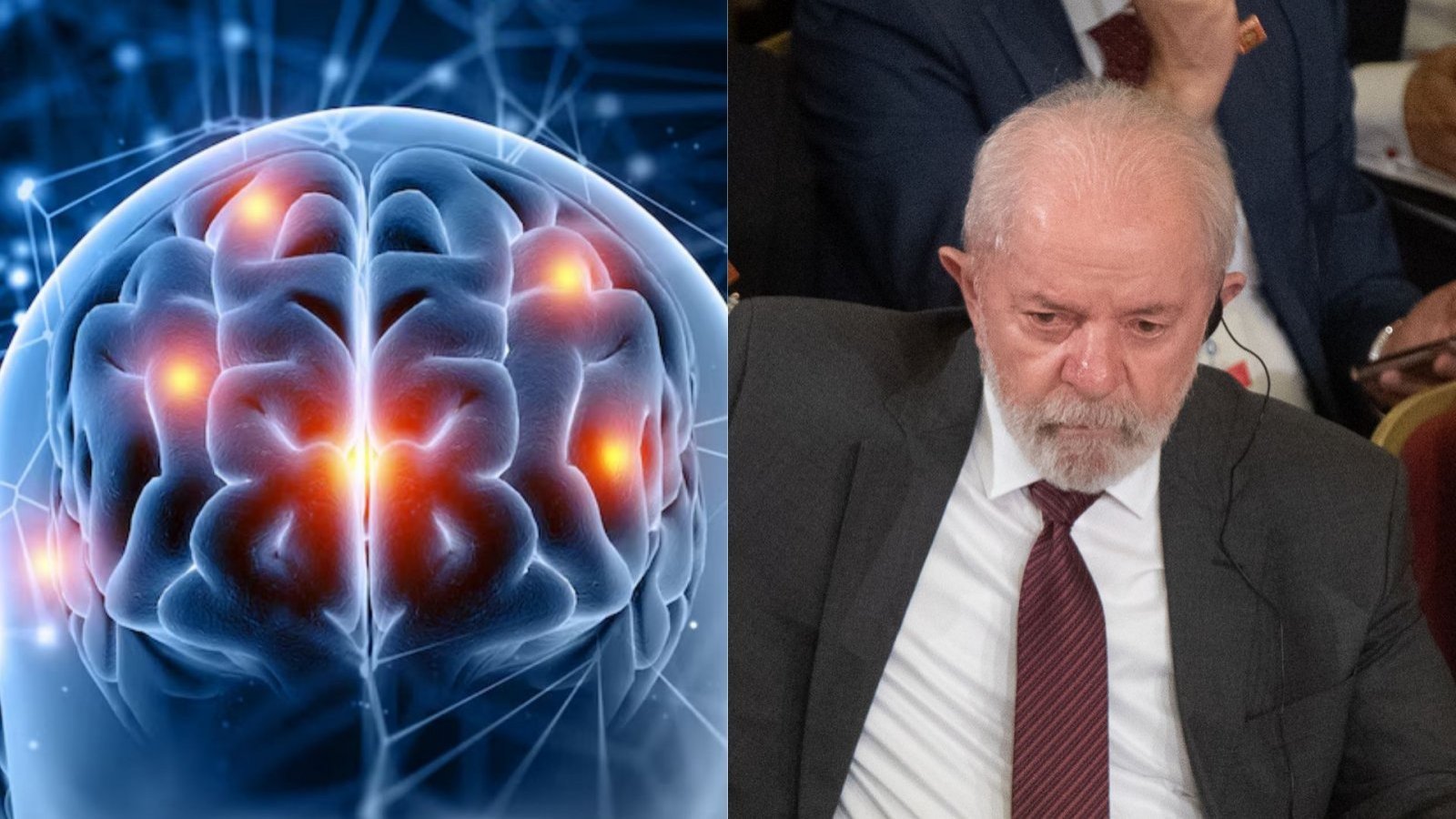 Qué es la hemorragia intracraneal