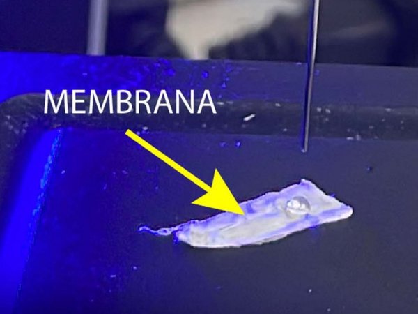 Primer plano de una membrana biocompatible sobre una úlcera en proceso de cicatrización, destacando su textura innovadora.