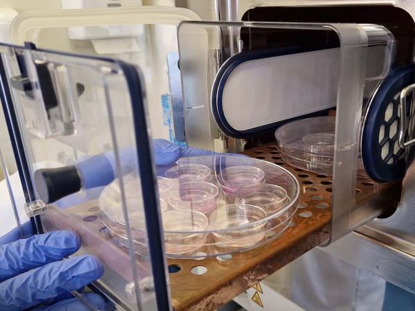 Técnico analiza tejido cerebral humano vivo bajo microscopio en laboratorio de neurociencia.