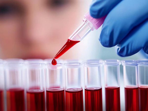 Equipo médico analiza muestras de sangre en laboratorio para detectar indicios tempranos de alzhéimer.
