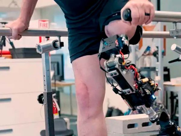 Rodilla biónica desarrollada por el MIT, integrada al hueso y músculos para restaurar movimiento natural.