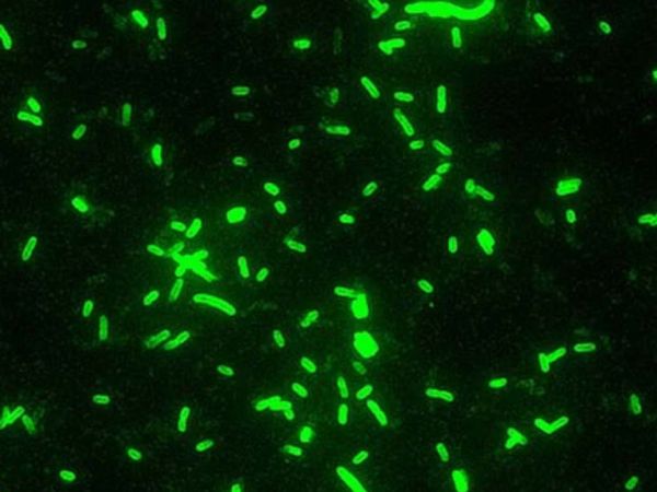Yersina Pestis.