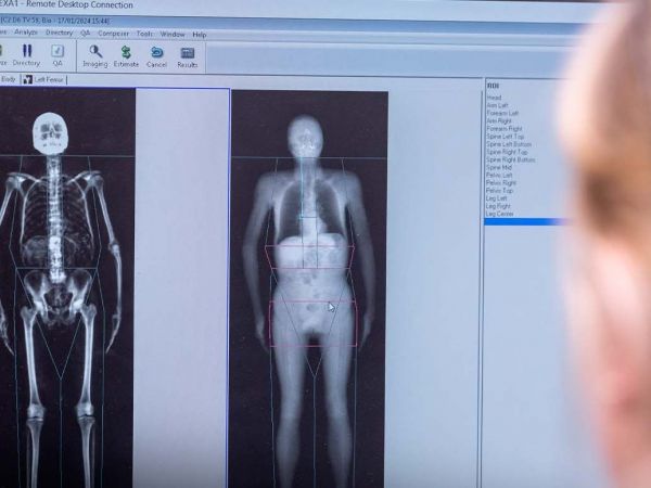 Escaneo 3D de 100 mil personas podría revolucionar diagnóstico médico realizado por UK Biobank.