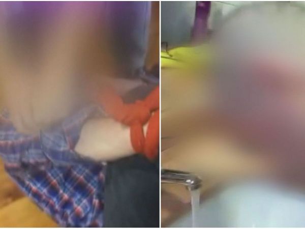 Funcionario agredido en Hospital de Osorno