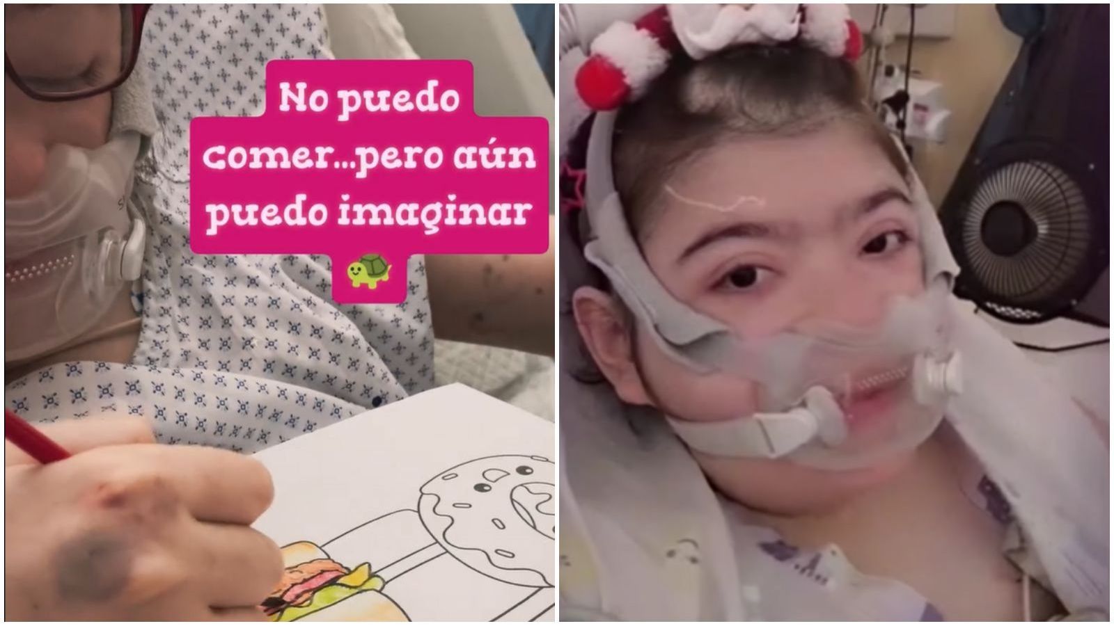 Joven chilena no puede comer y sueña con dibujar comida
