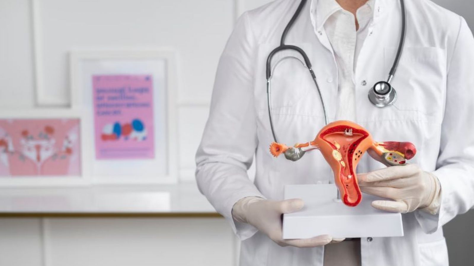 Cáncer cervicouterino
