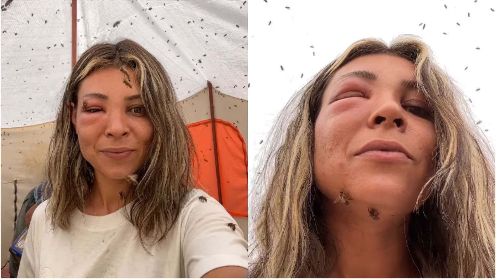 Mujer se hace picar por miles de abejas "por salud"