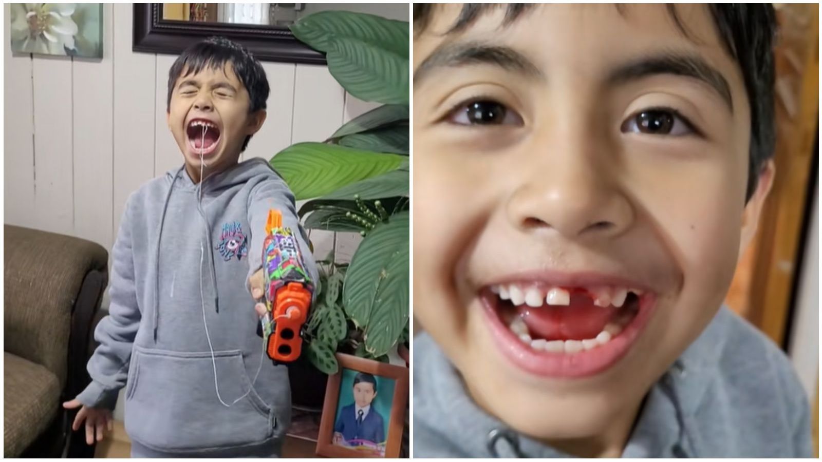 Niño de 8 años se sacó un diente