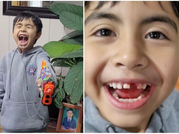 Niño de 8 años se sacó un diente