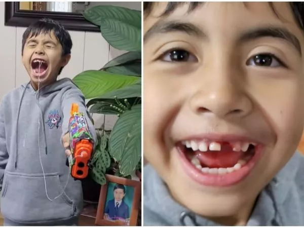 Niño de 8 años se sacó un diente