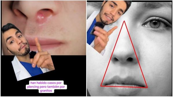 Dermatólogo explica triángulo de la muerte