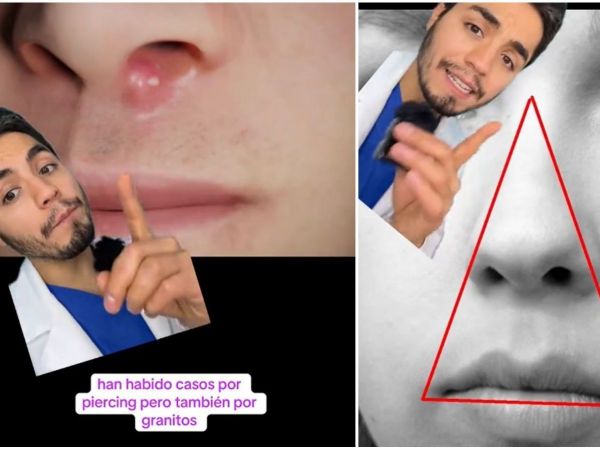 Dermatólogo explica triángulo de la muerte