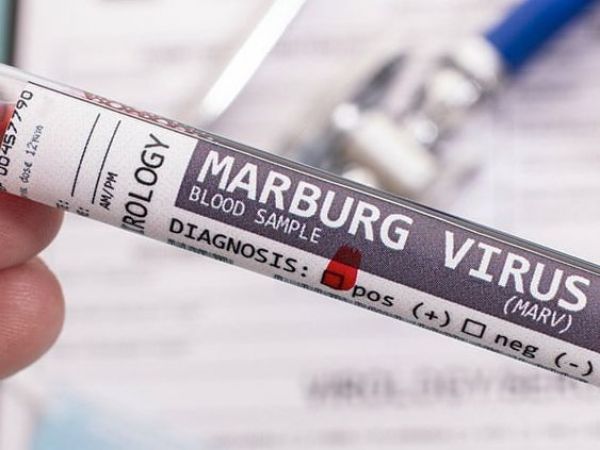 Marburgo virus en Etiopía