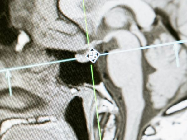 Imagen ilustrativa del cerebro humano mostrando conexiones neuronales.