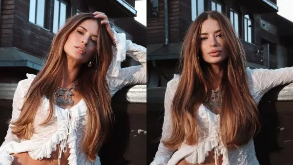 ANTES y DESPUÉS de Julia Fernandes tras cirugía en su cara