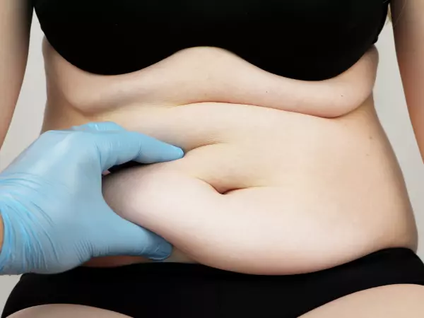 Doctor realizando un diagnóstico para una abdominoplastía