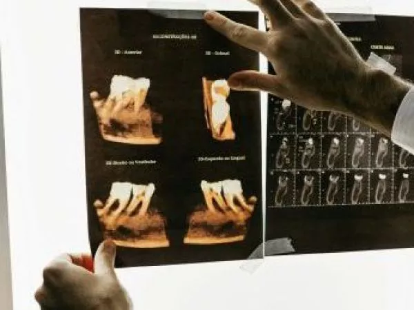 dentista punta arenas